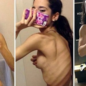 Genç kadın azmi sayesinde ölümcül hastalıktan kurtuldu. Sarah Ramadan bir