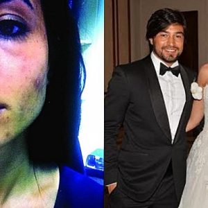 Eylem Toraman’ın avukatı, İbrahim Toraman’dan dayak yiyen müvekkilinin yüzünün gözünün
