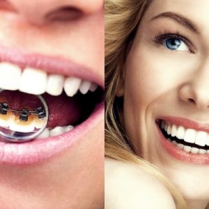 Gülümserken güzel görünen bir yüze, daha sağlıklı ve estetik dişlere