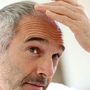 Japon şirketlerin ortak çalışması sonucu kök hücrelerden saç folikülü üretilmesi,