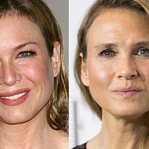 47 yaşındaki Renee Zellweger estetik iddialarına nihayet yanıt verdi. Göz