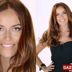 Ünlü oyuncu Fahriye Evcen’in hakkında çıkan estetik haberlerine hayranları büyük