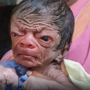 Dünya basınının da ilgisini çeken bebeği görmeye her gün meraklı