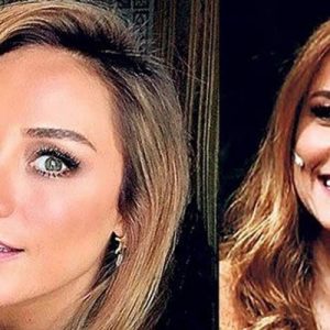 Botoks yaptıran, yüzünü vitamin iğneleriyle canlandıran oyuncunun yeni imaj fotoğrafı