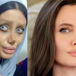 İranlı genç kız, Angelina Jolie’ye benzemek için bir servet harcadı.