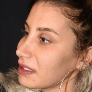 Şarkıcı İrem Derici’nin tükenmişlik sendromuna yakalanıp Rehabilitasyon Merkezi’nde tedavi gördüğü