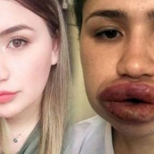 Kendisini doktor olarak tanıtan kuaföre silikon yaptırdıktan sonra rahatsızlanan ve