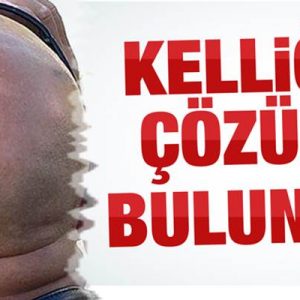 Osteoporoz tedavisinde kullanılan bir ilaç laboratuvar ortamında kıl foliküllerinin büyümesini