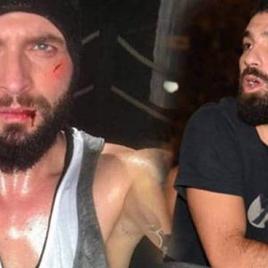 Futbolcu Arda Turan’ın burnunu kırdığı şarkıcı Berkay’ın hastanedeki tedavisi sürüyor.