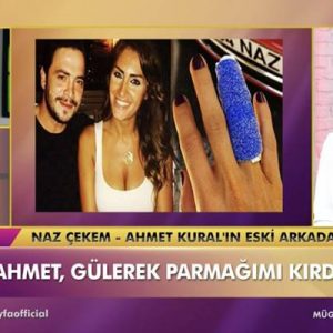 Ahmet Kural’ın 2014 yılında parmağını kırdığı iddia edilen Naz Çekem,