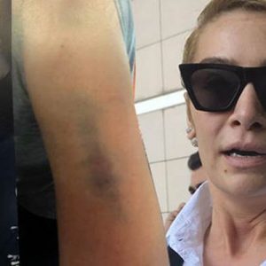 Sevgilisi Ahmet Kural tarafından şiddet gördüğü için şikayetçi olarak 3