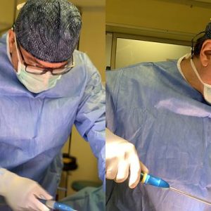 Liposuction vücudun belli başlı bölgelerinde kontür yapısını bozan fazla yağlı