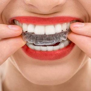 Diş Hekimi Denizhan Uzunpınar, şeffaf plakalar ile düzgün ve sağlıklı