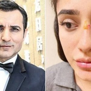 Ünlü şarkıcı Rafet El Roman, sevgilisi tarafından şiddete uğrayan eski