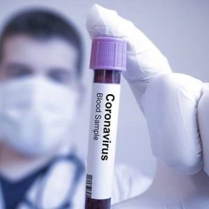 Çin’den başlayıp tüm dünyayı etkisi altına alan corona virüs can