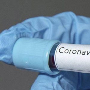 JAMA Neuology adlı dergide yayınlanan bir araştırmada, koronavirüse yakalananların koordinasyon