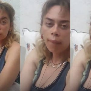 Oyuncu Demet Evgar sosyal medya hesabı Instagram’dan yüzünü arı soktuğunu