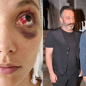 Hürriyet gazetesi yazarı Onur Baştürk, sevgilisi Deniz Bulutsuz’u darp ettiği