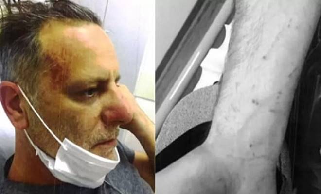 Hürriyet’in haberine göre, Ozan Güven’in eski sevgilisi Deniz Bulutsuz tarafından