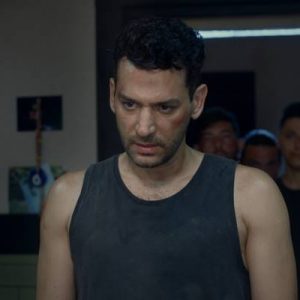 Sette yüzüne darbe alan oyuncunun vücudunda şişlik ve morluk oluştu.