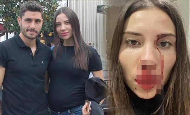 Mihriban Hurmacı’nın eşi Özer Hurmacı’nın kendisini darp ettiği gerekçesiyle karşılıklı